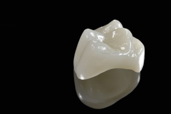 Popularity And Availability Of CEREC Crowns